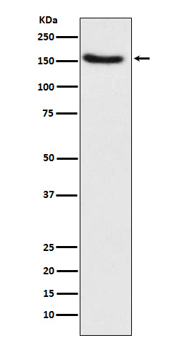 1 - Anti-Hamartin Rabbit Monoclonal Antibody ABO15757