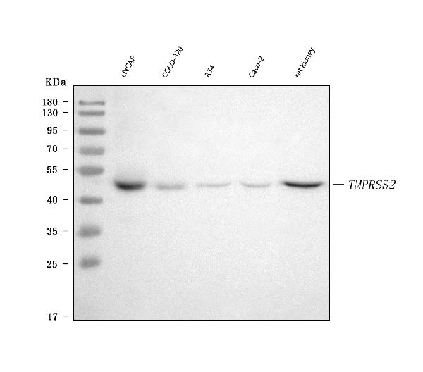 1 - Anti-TMPRSS2 Rabbit Monoclonal Antibody ABO15758