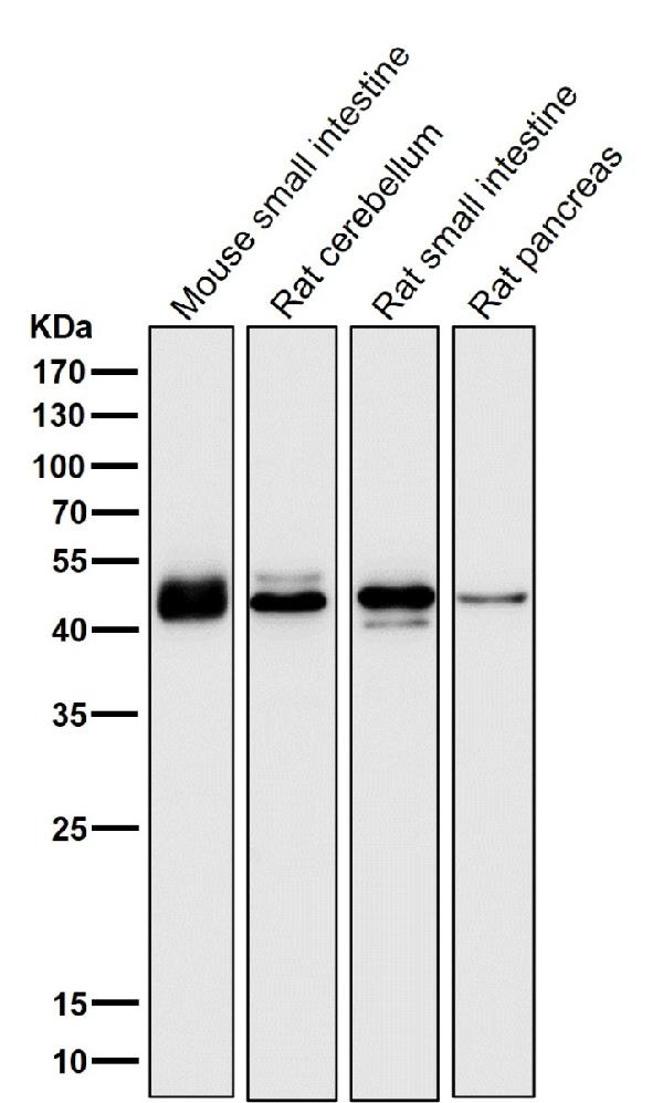 1 - Anti-TMPRSS2 Rabbit Monoclonal Antibody ABO15758