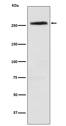 1 - Anti-CAD Rabbit Monoclonal Antibody ABO15759