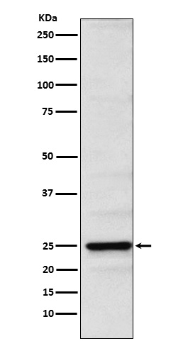 1 - Anti-Neurogenin 2 Rabbit Monoclonal Antibody ABO15761
