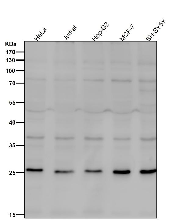 1 - Anti-Neurogenin 2 Rabbit Monoclonal Antibody ABO15761