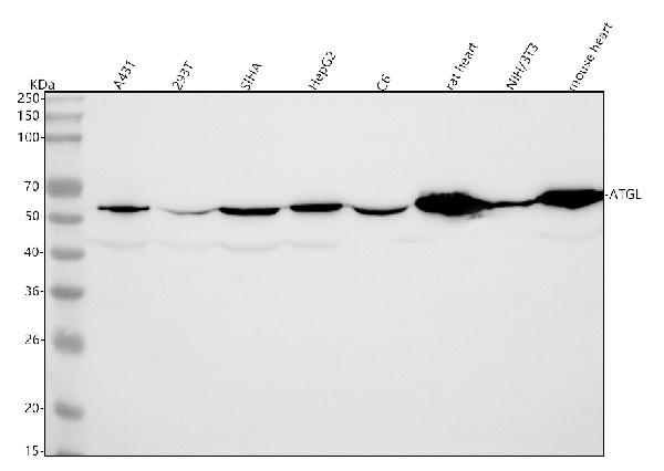 1 - Anti-ATGL / PNPLA2 Rabbit Monoclonal Antibody ABO15762