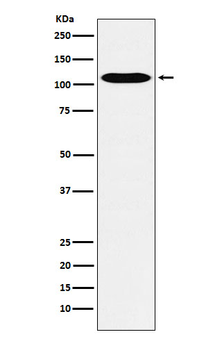 1 - Anti-GPCR / LGR6 Rabbit Monoclonal Antibody ABO15763