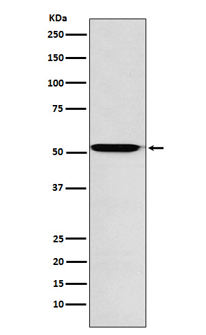 1 - Anti-ACVR1B Rabbit Monoclonal Antibody ABO15764