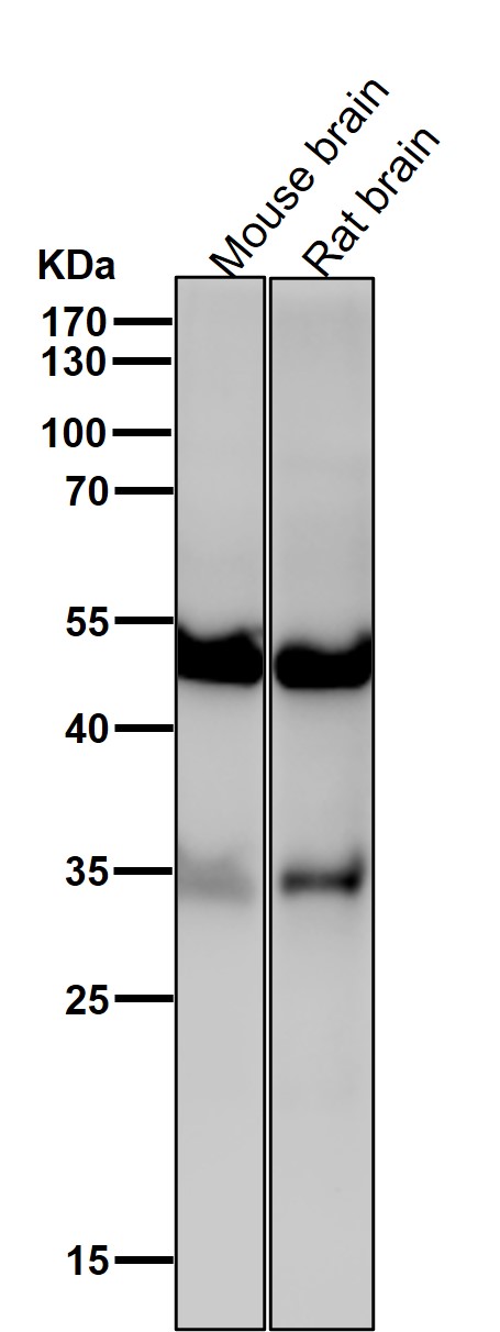 1 - Anti-ACVR1B Rabbit Monoclonal Antibody ABO15764