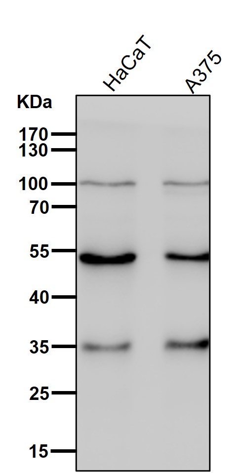 1 - Anti-ACVR1B Rabbit Monoclonal Antibody ABO15764