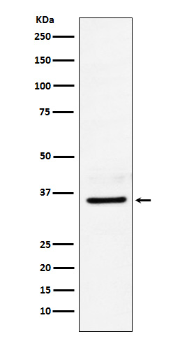 1 - Anti-LDHB Rabbit Monoclonal Antibody ABO15766