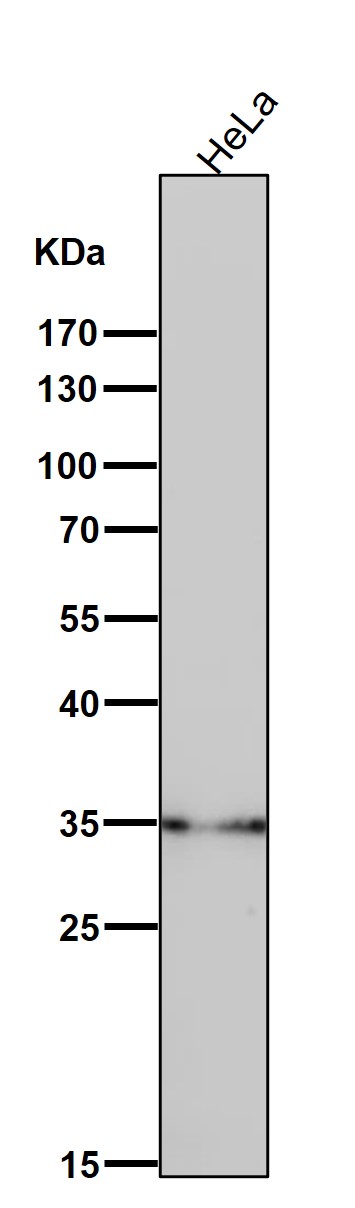 1 - Anti-LDHB Rabbit Monoclonal Antibody ABO15766