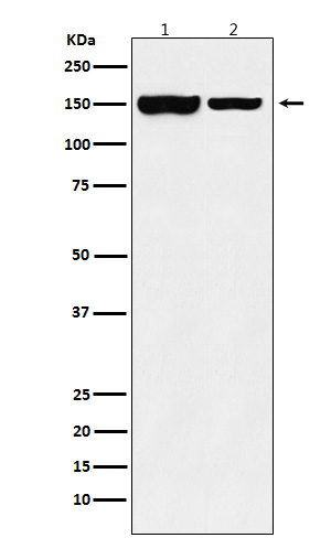 1 - Anti-KDM4B / JMJD2B Rabbit Monoclonal Antibody ABO15767