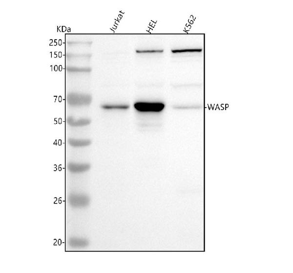 1 - Anti-WASP Rabbit Monoclonal Antibody ABO15768