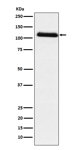 1 - Anti-Fibrinogen alpha chain Rabbit Monoclonal Antibody ABO15770