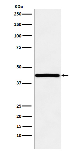 1 - Anti-HOXA13 Rabbit Monoclonal Antibody ABO15780