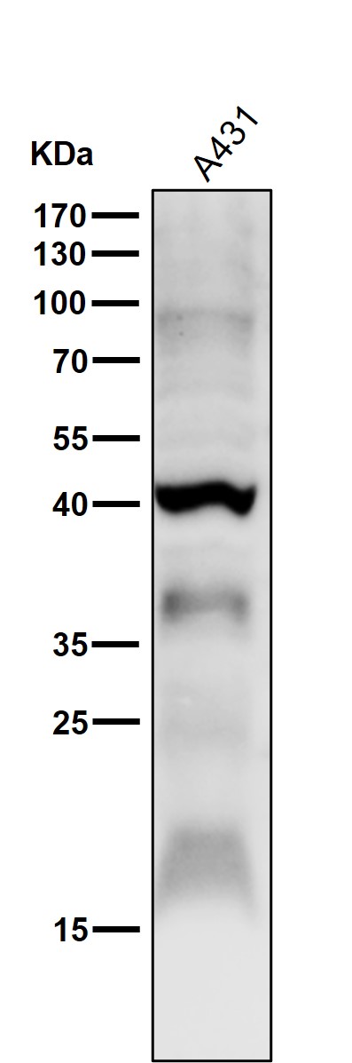 1 - Anti-HOXA13 Rabbit Monoclonal Antibody ABO15780