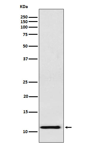 1 - Anti-fetal hemoglobin Rabbit Monoclonal Antibody ABO15782