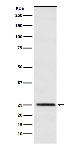 1 - Anti-Triosephosphate isomerase Rabbit Monoclonal Antibody ABO15783