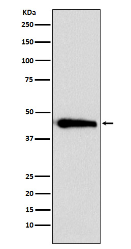 1 - Anti-ASS1 Rabbit Monoclonal Antibody ABO15786