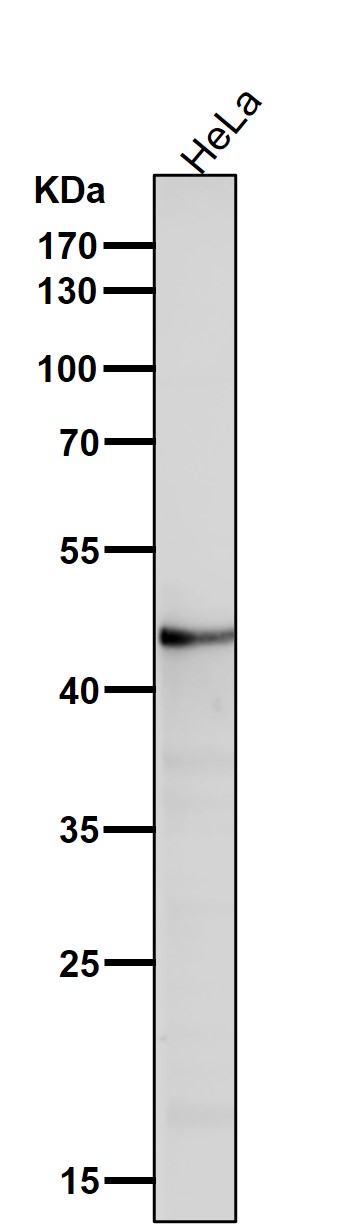 1 - Anti-ASS1 Rabbit Monoclonal Antibody ABO15786