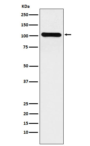 1 - Anti-BACH1/BRIP1 Rabbit Monoclonal Antibody ABO15788