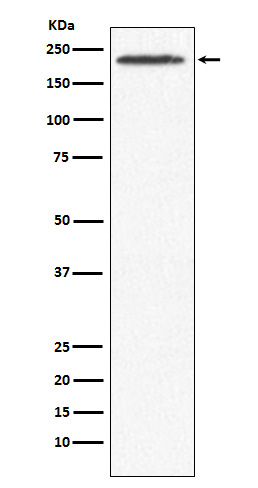 1 - Anti-SMCHD1 Rabbit Monoclonal Antibody ABO15789