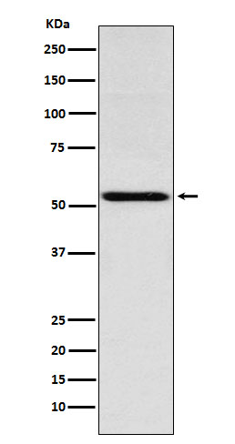 1 - Anti-THRA Rabbit Monoclonal Antibody ABO15790