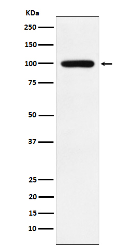 1 - Anti-Calmegin Rabbit Monoclonal Antibody ABO15792
