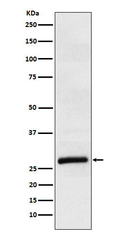 1 - Anti-ApoM Rabbit Monoclonal Antibody ABO15795