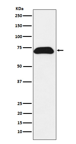 1 - Anti-PDZK1 Rabbit Monoclonal Antibody ABO15796