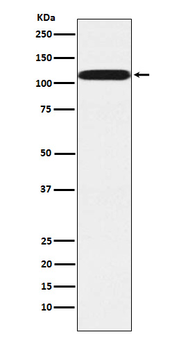 1 - Anti-Pumilio 2 Rabbit Monoclonal Antibody ABO15798