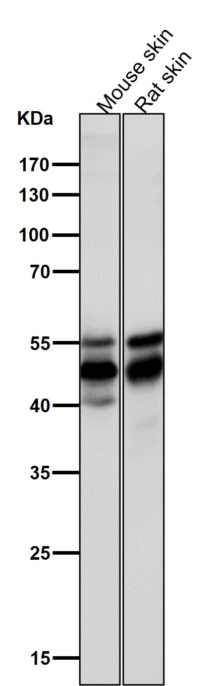 1 - Anti-AP2 alpha Rabbit Monoclonal Antibody ABO15800