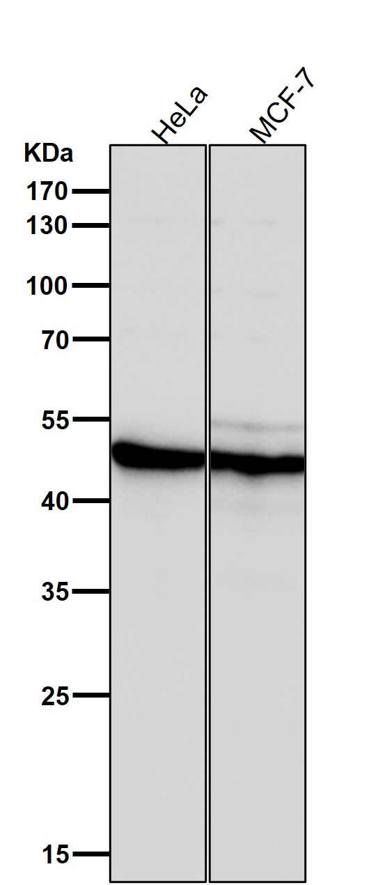 1 - Anti-AP2 alpha Rabbit Monoclonal Antibody ABO15800