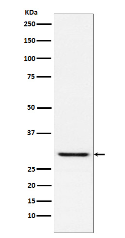 1 - Anti-TIRAP Rabbit Monoclonal Antibody ABO15801