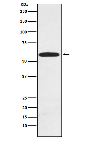 1 - Anti-RAD23A Rabbit Monoclonal Antibody ABO15804