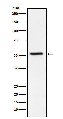 1 - Anti-TrpRS Rabbit Monoclonal Antibody ABO15806
