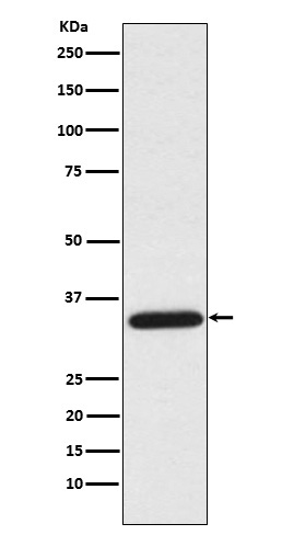 1 - Anti-UNG Rabbit Monoclonal Antibody ABO15807