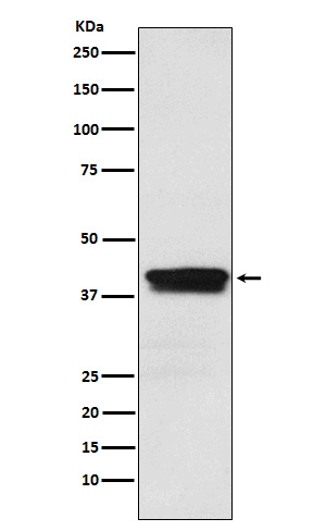 1 - Anti-MBNL1 Rabbit Monoclonal Antibody ABO15808