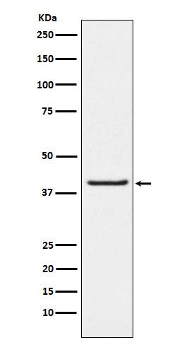 1 - Anti-PAR4 Rabbit Monoclonal Antibody ABO15810