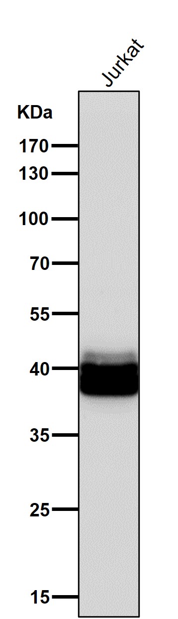 1 - Anti-PAR4 Rabbit Monoclonal Antibody ABO15810