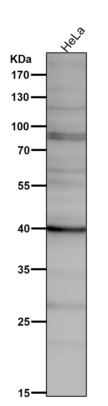 1 - Anti-PAR4 Rabbit Monoclonal Antibody ABO15810