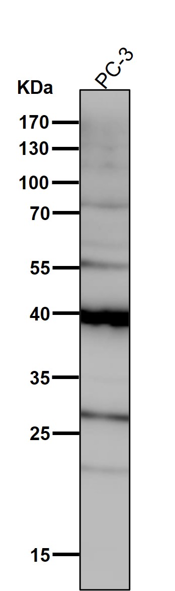 1 - Anti-PAR4 Rabbit Monoclonal Antibody ABO15810