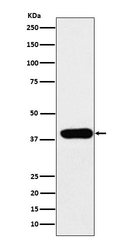 1 - Anti-ADA Rabbit Monoclonal Antibody ABO15811