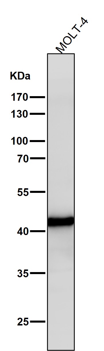 1 - Anti-ADA Rabbit Monoclonal Antibody ABO15811