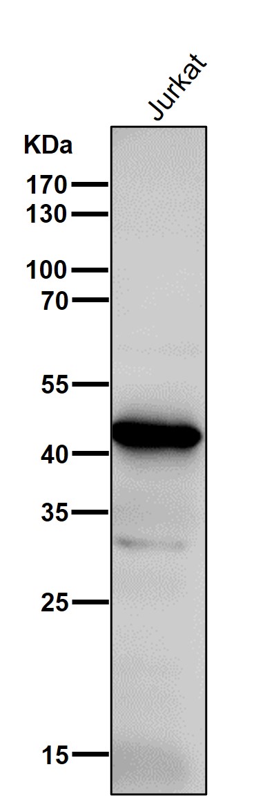 1 - Anti-ADA Rabbit Monoclonal Antibody ABO15811
