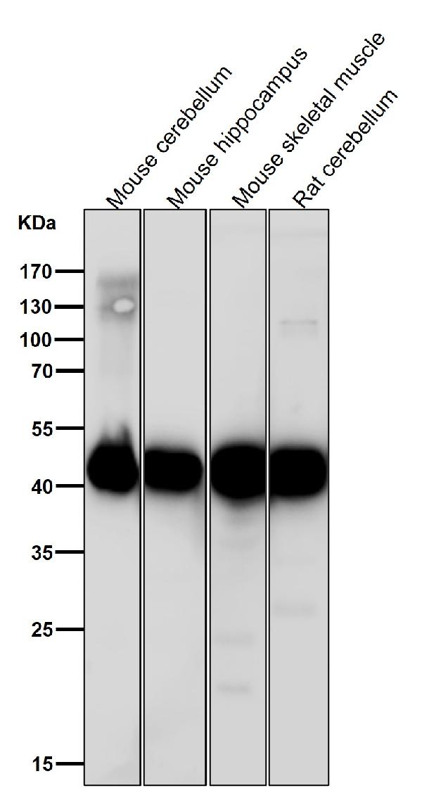 1 - Anti-ADA Rabbit Monoclonal Antibody ABO15811