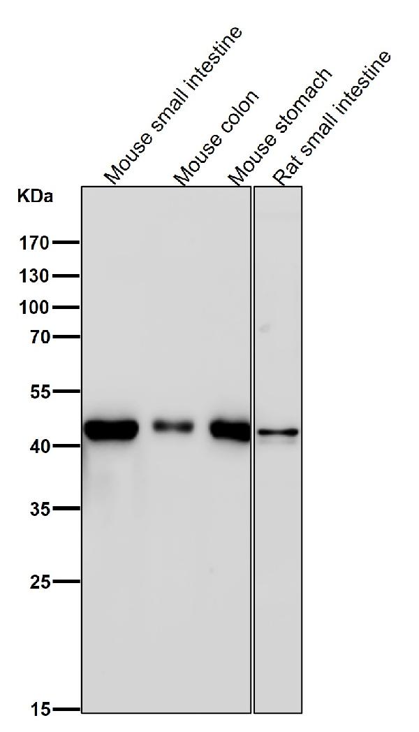 1 - Anti-ADA Rabbit Monoclonal Antibody ABO15811