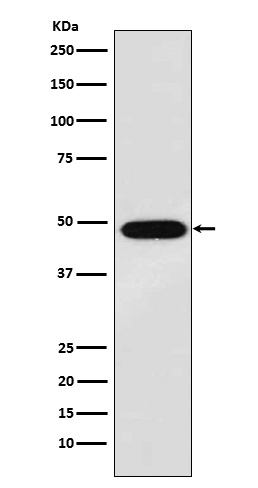 1 - Anti-MAGE 1 Rabbit Monoclonal Antibody ABO15813