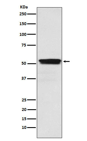 1 - Anti-ACM2 Rabbit Monoclonal Antibody ABO15814