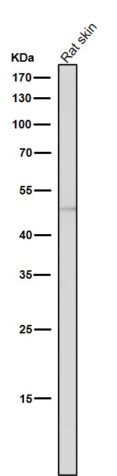 1 - Anti-ACM2 Rabbit Monoclonal Antibody ABO15814