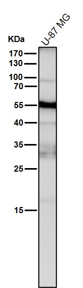 1 - Anti-ACM2 Rabbit Monoclonal Antibody ABO15814