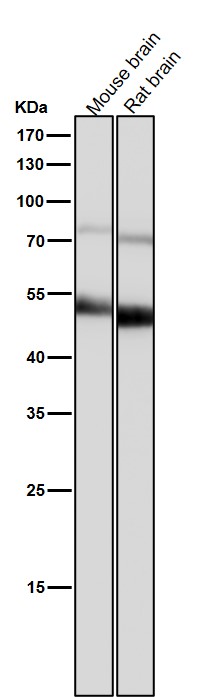 1 - Anti-ACM2 Rabbit Monoclonal Antibody ABO15814